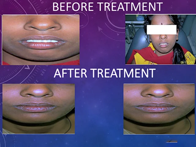 Dentist performing precise teeth alignment procedure at Diksha Dental Clinic Coimbatore