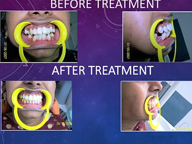 Effective teeth straightening solutions for all ages at Diksha Dental Clinic Coimbatore